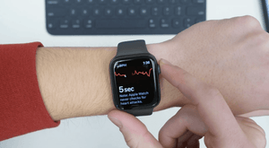 Apple Watch ECG dapat meluas ke Jepang dan Brasil berikutnya, berdasarkan pengajuan pemerintah baru-baru ini