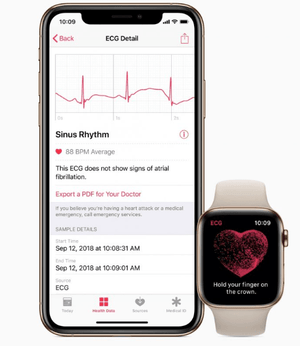 Cara menggunakan aplikasi ECG di Apple Watch