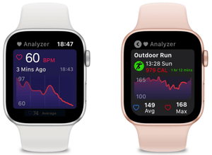 Heart Analyzer merombak aplikasi Apple Watch-nya, sekarang Anda dapat melihat lebih banyak data dari sebelumnya